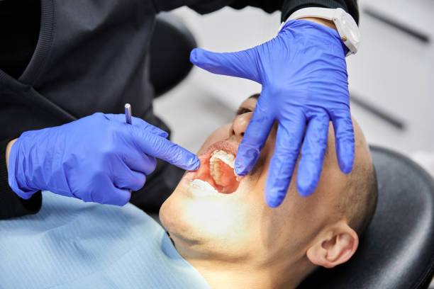 Best Emergency Gum Pain Relief  in Rutherfordton, NC
